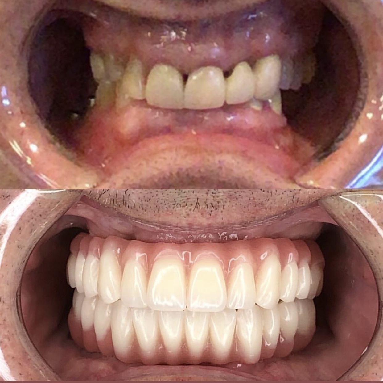 Full Teeth Help Smiles. Apache Junction Affordable Dentist