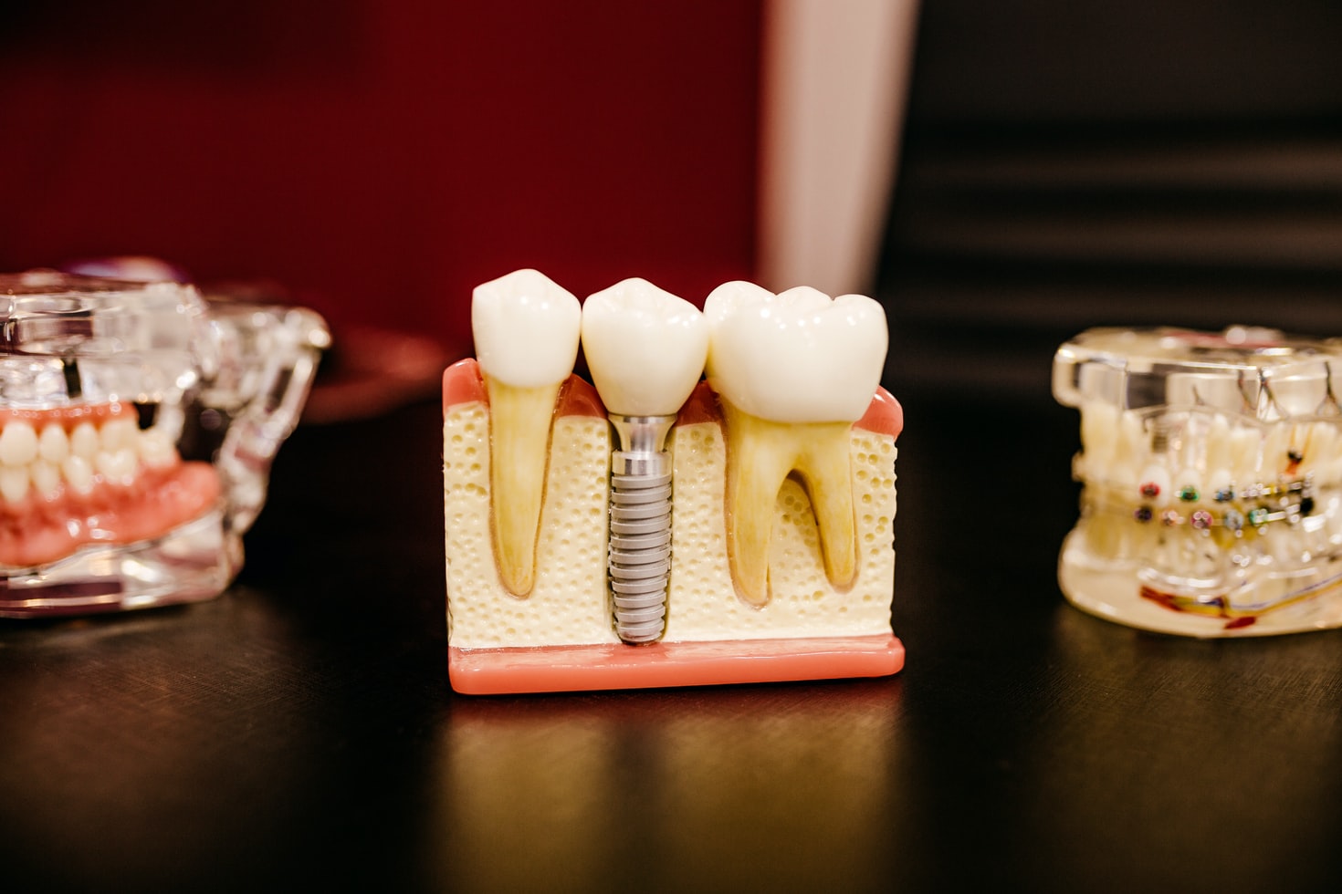Schedule a Root Canal Consultation with Us!