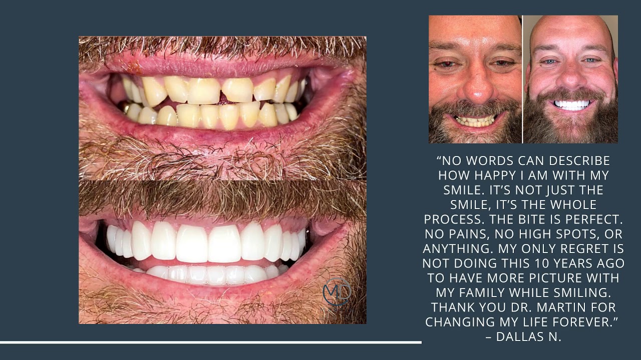 Chandler Affordable Dentist. How To Halt Gum Recession